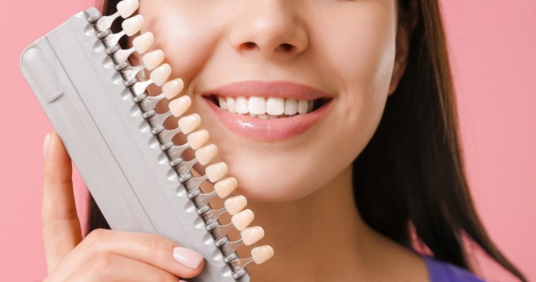 Transform Your Smile with Natural-Looking and Affordable Veneers